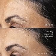 C-Tetra™ Advanced Gel-Serum