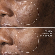 C-Tetra™ Advanced Gel-Serum