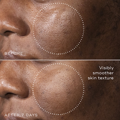 C-Tetra™ Advanced Gel-Serum