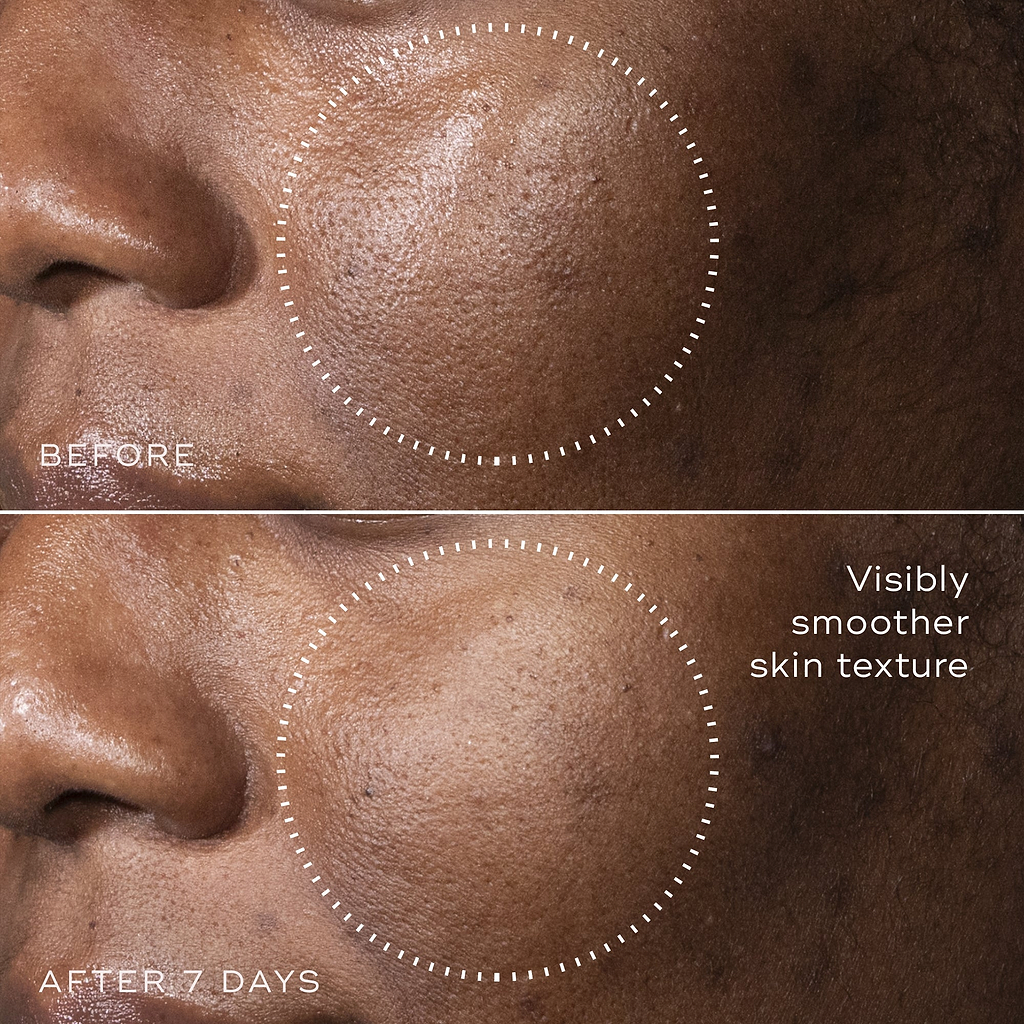 C-Tetra™ Advanced Gel-Serum