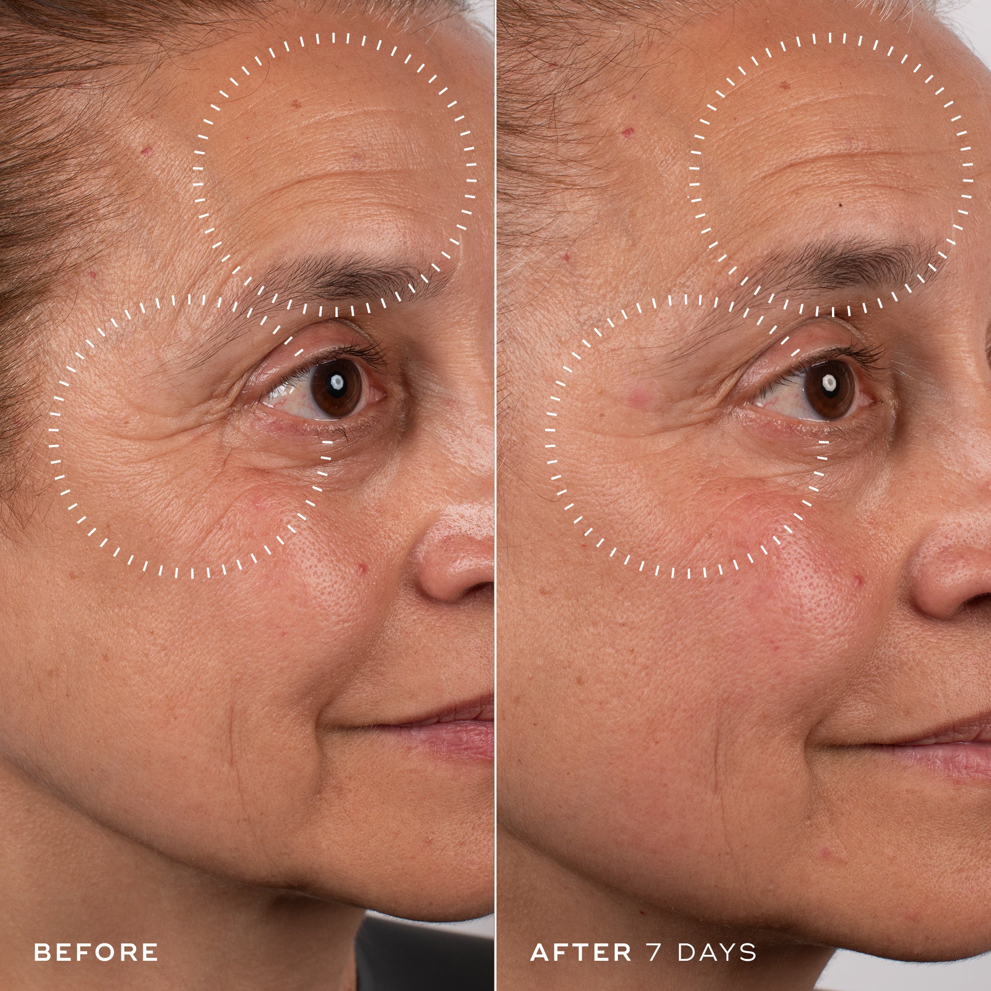 ghk cu before and after Official Medik8 US – Medik8-US