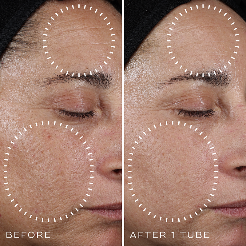 ghk-cu reddit before and after Pictures Neurogan Health 8 Months + 3 Weeks