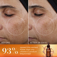A side-by-side "Before" and "After 28 Days" comparison of a person's cheek and eye area. A white dashed circle highlights a reduction in the appearance of dark spots and uneven pigmentation in the "After" image. A bold orange banner at the bottom features the statement: "93% agreed this worked faster than any vitamin C product they'd tried*". The Super C Ferulic serum bottle is shown in the bottom right corner against a splashing amber liquid background.