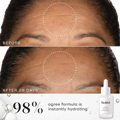 A before-and-after close-up of a forehead, showing smoother skin in the circled area in the "After 28 Days" image compared to "Before." Text states "98% agree formula is instantly hydrating*". A bottle of Medik8 Liquid Peptides serum is displayed in the corner against a background of clear liquid bubbles.