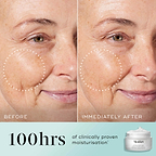 A split-screen before-and-after comparison of a woman's cheek and eye area, with a dotted circle highlighting visibly plumped skin and reduced wrinkles in the "IMMEDIATELY AFTER" photo. Text states "100 hours of clinically proven moisturisation*" alongside an image of the Medik8 Total Moisture jar.