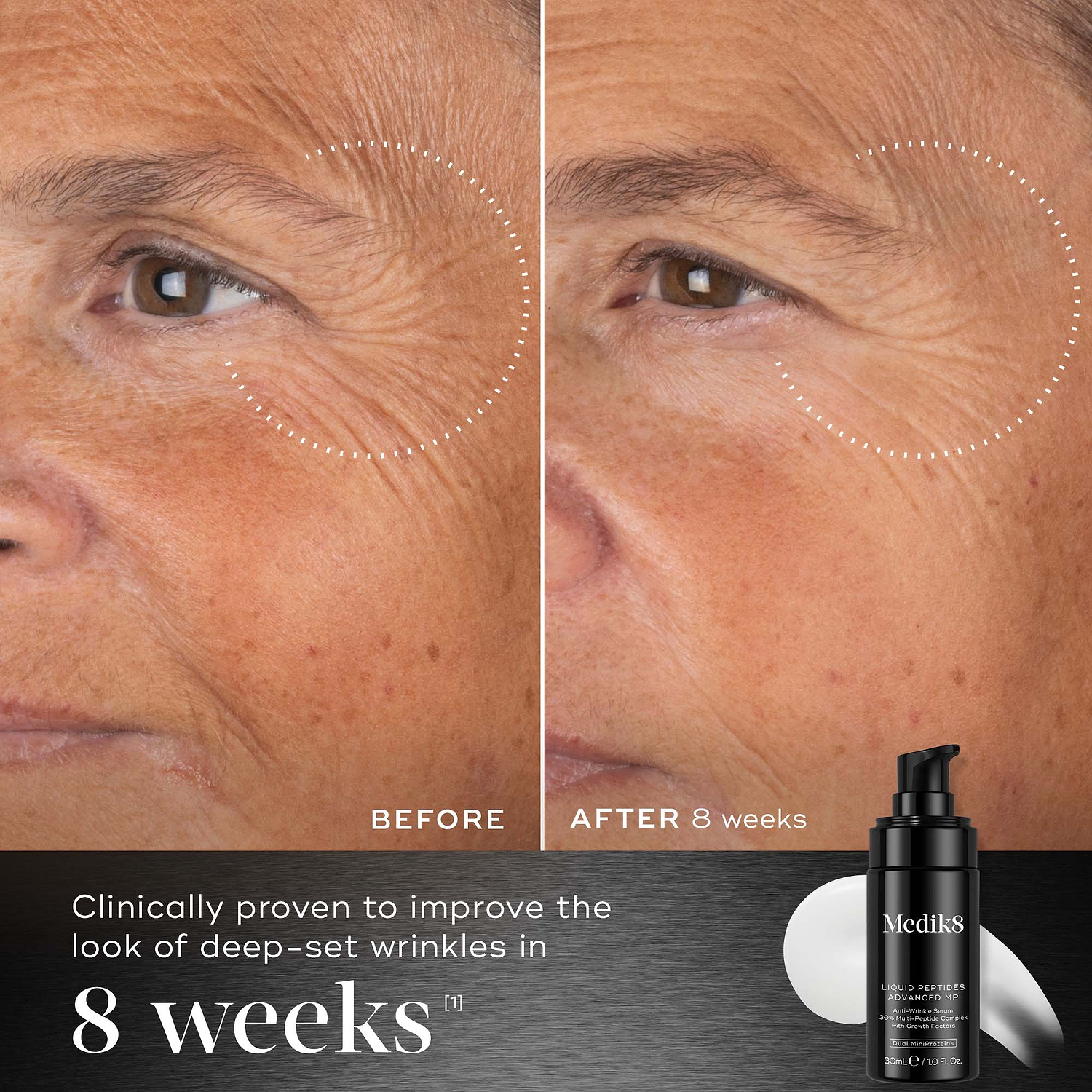 Before and after 8 weeks comparison shows the eye and cheek area of a person, illustrating a reduction in the look of deep-set wrinkles. Below the images, text states "Clinically proven to improve the look of deep-set wrinkles in 8 weeks".