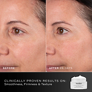 Before and after comparison showing visible improvement in smoothness and firmness after 28 days using Medik8 Advanced Pro-Collagen+ Peptide Cream. Bottom text confirms clinical results.