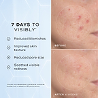 A split image showing a close-up of skin texture labelled "Before" and "After 4 Weeks," highlighting improvements. Text on the left lists benefits: "Reduced blemishes," "Improved skin texture," "Reduced pore size," and "Soothed visible redness."