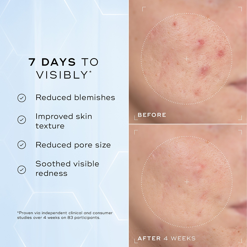 A split image showing a close-up of skin texture labelled "Before" and "After 4 Weeks," highlighting improvements. Text on the left lists benefits: "Reduced blemishes," "Improved skin texture," "Reduced pore size," and "Soothed visible redness."