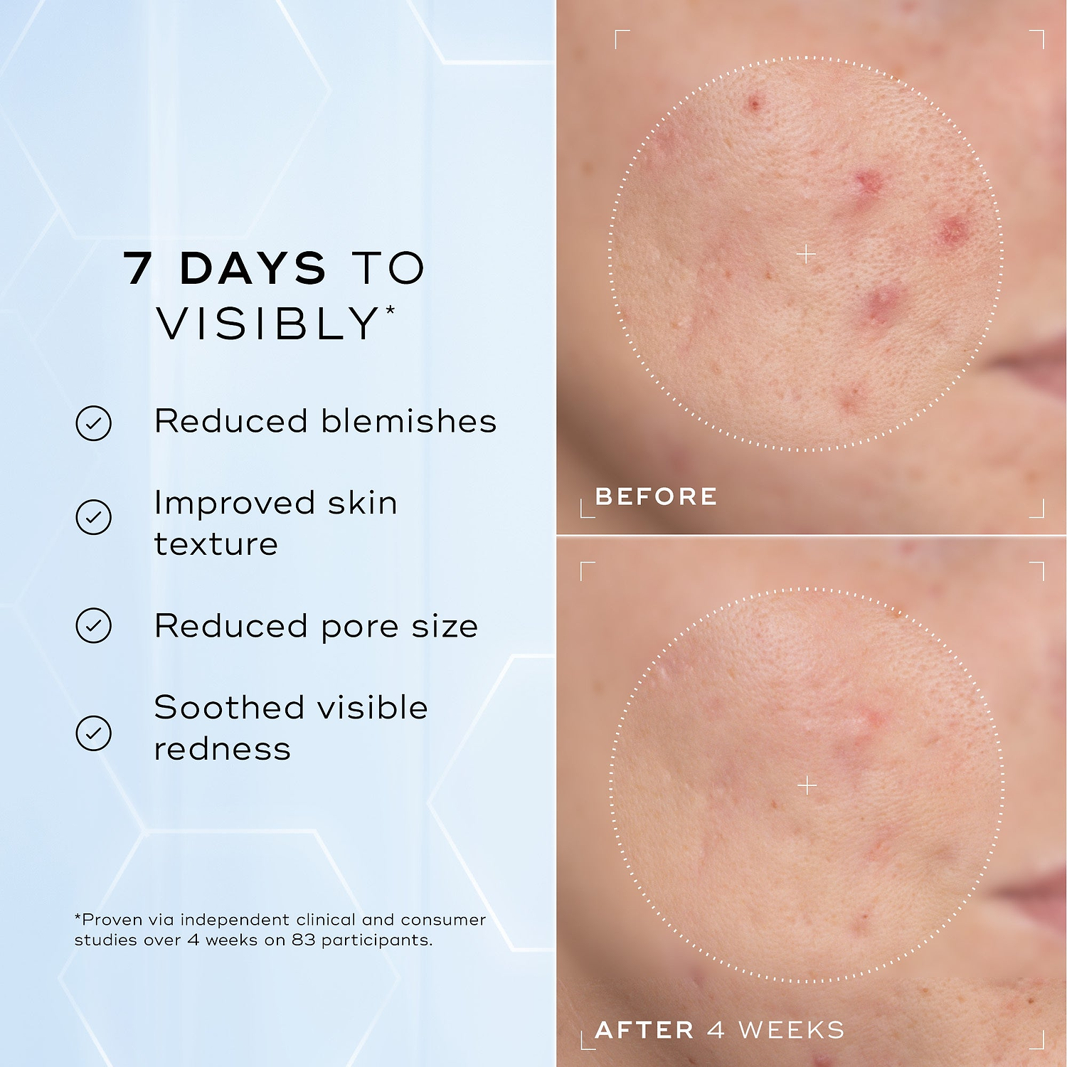 A split image showing a close-up of skin texture labelled "Before" and "After 4 Weeks," highlighting improvements. Text on the left lists benefits: "Reduced blemishes," "Improved skin texture," "Reduced pore size," and "Soothed visible redness."