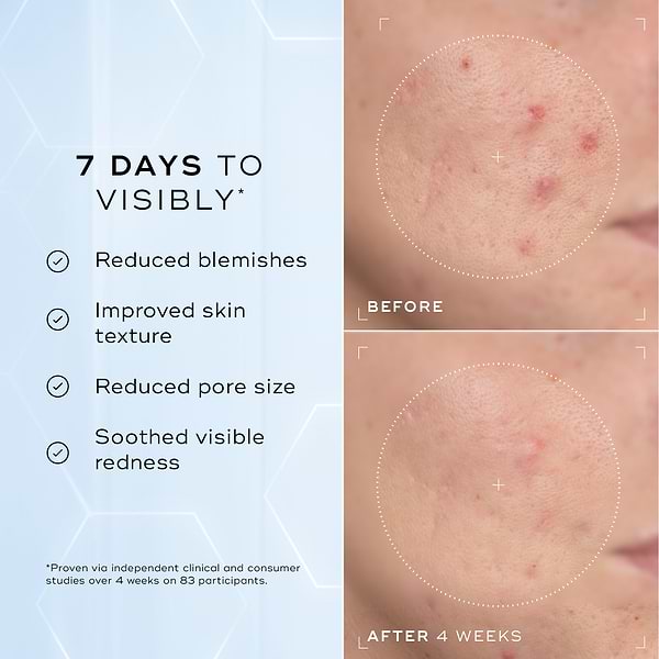 A split image showing a close-up of skin texture labelled "Before" and "After 4 Weeks," highlighting improvements. Text on the left lists benefits: "Reduced blemishes," "Improved skin texture," "Reduced pore size," and "Soothed visible redness."