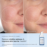 Side-by-side "Before" and "After 4 Weeks" close-ups of a cheek with redness and texture issues. Text below states "Clinically proven to visibly reduce visible redness & improve skin barrier health*."
