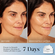 A side-by-side comparison of a woman's face labeled "Before" and "Immediately After," showing visibly hydrated and glowing skin. Text states "Proven to Smooth Stubborn Wrinkles & Visibly Lift Skin in just 7 Days*". The Advanced Night Restore jar is displayed in the corner.