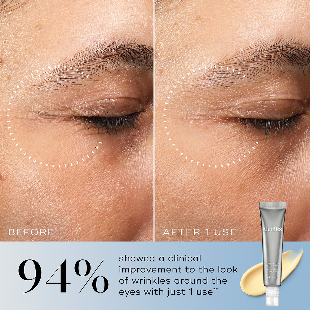 A before-and-after close-up of an eye area, showing visibly reduced wrinkles in the "After 1 Use" image. Text highlights "94% showed a clinical improvement to the look of wrinkles around the eyes with just 1 use**". A tube of Crystal Retinal Ceramide Eye is shown in the corner.