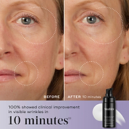 A before-and-after close-up of a face, showing smoothed skin around the eye and mouth in the "After 10 minutes" image compared to "Before." Text states "100% showed clinical improvement in visible wrinkles in 10 minutes*". A bottle of Liquid Peptides Advanced MP is displayed in the corner.