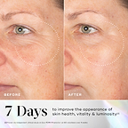 A before-and-after close-up of a participant's eye and cheek area, with dotted circles highlighting visibly smoother skin and reduced fine lines in the "AFTER" image. Text states "7 Days to improve the appearance of skin health, vitality & luminosity". A footnote references an independent clinical study on Exo-PDRN Prismatic+ on 60 volunteers over 4 weeks.