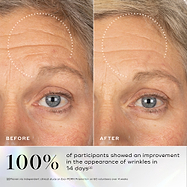 Before-and-after images of skin showing visible wrinkles around the eye area with improvement highlighted after using Medik8 Exo-PDRN Prismatic+ serum.
