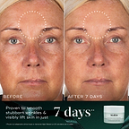 A before-and-after close-up of a participant's face over 7 days, demonstrating smoother skin on the forehead, highlighted by a dotted circle. Text states "Proven to smooth stubborn wrinkles & visibly lift skin in just 7 days." An Advanced Night Restore travel size jar sits in the bottom right corner against a dark green background.