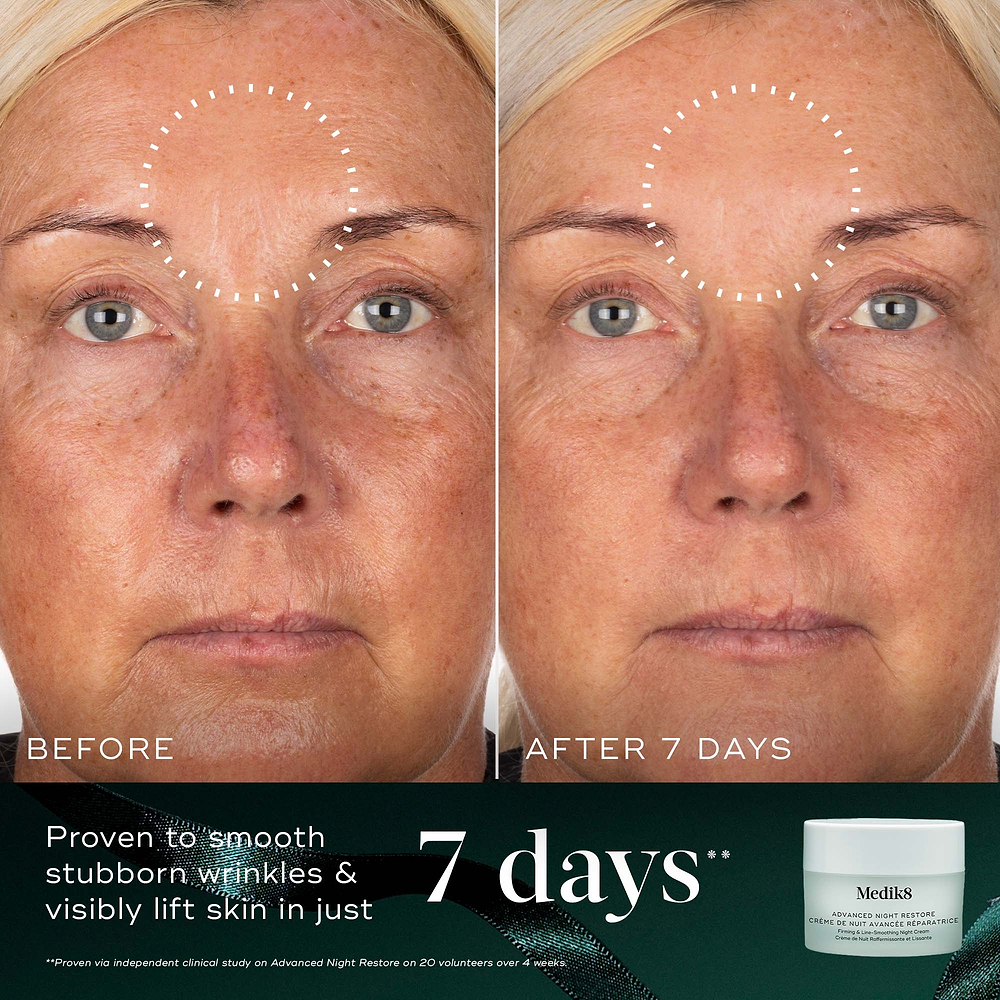 A before-and-after close-up of a participant's face over 7 days, demonstrating smoother skin on the forehead, highlighted by a dotted circle. Text states "Proven to smooth stubborn wrinkles & visibly lift skin in just 7 days." An Advanced Night Restore travel size jar sits in the bottom right corner against a dark green background.