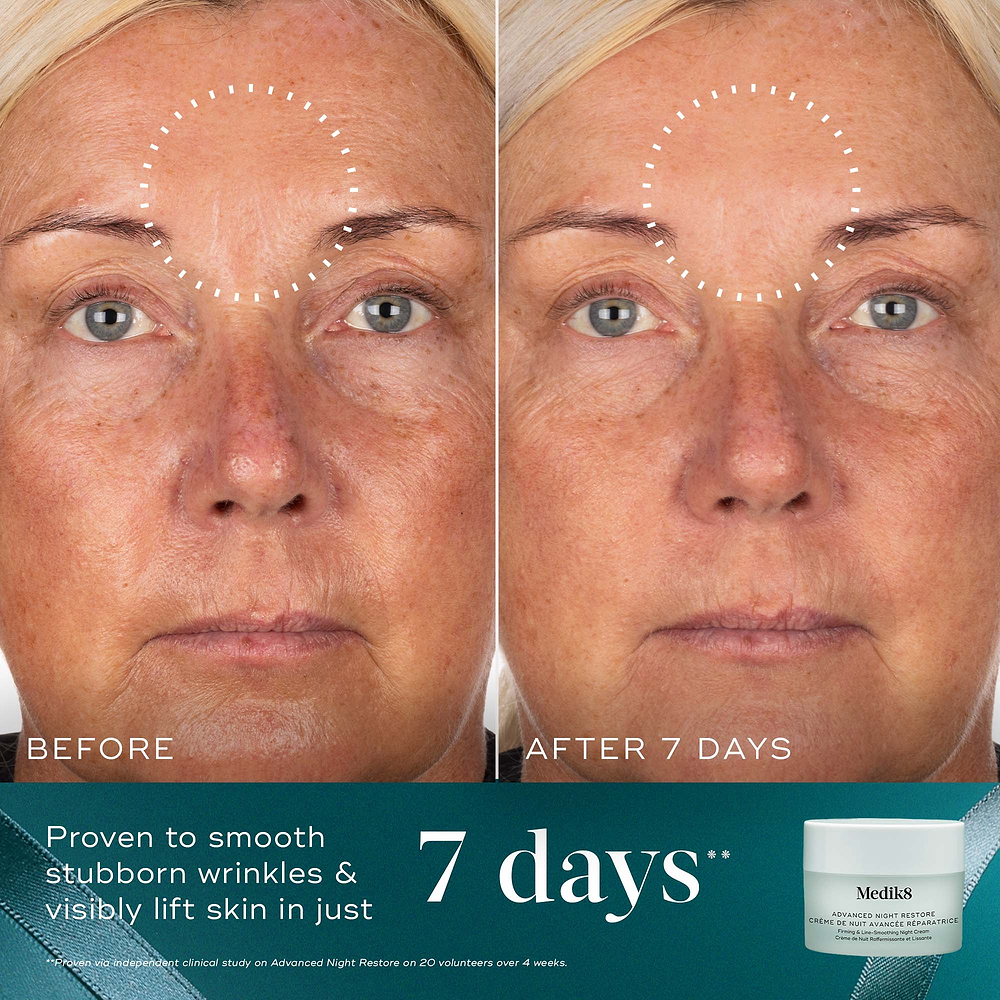 A before-and-after close-up of a participant's forehead over 7 days, demonstrating smoother skin, highlighted by a dotted circle. Text states "Proven to smooth stubborn wrinkles & visibly lift skin in just 7 days." An Advanced Night Restore jar sits in the bottom right corner against a teal background with a ribbon.