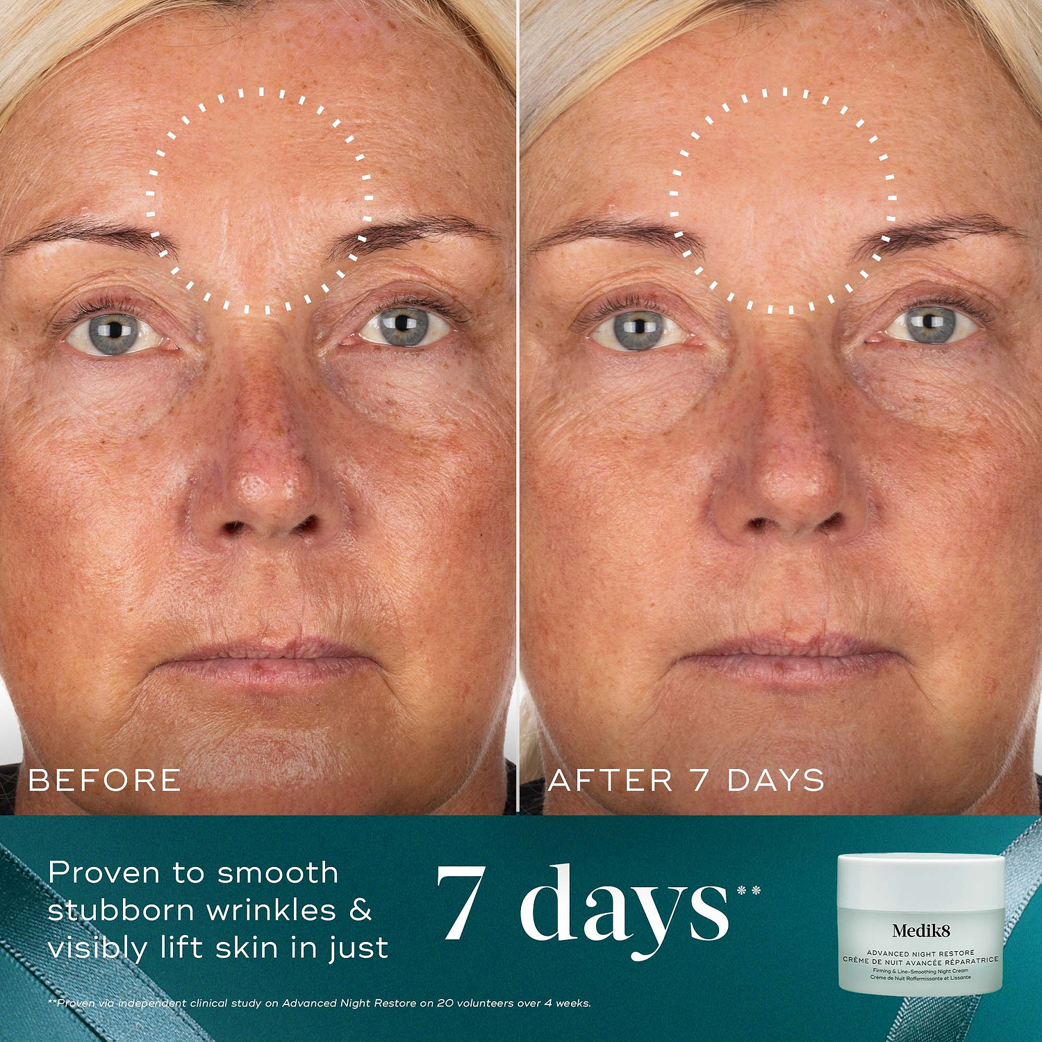 A before-and-after close-up of a participant's forehead over 7 days, demonstrating smoother skin, highlighted by a dotted circle. Text states "Proven to smooth stubborn wrinkles & visibly lift skin in just 7 days." An Advanced Night Restore jar sits in the bottom right corner against a teal background with a ribbon.
