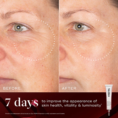 A before-and-after close-up of a participant's cheek and eye area over 7 days, demonstrating improved skin tone and luminosity, highlighted by a dotted circle. Text states "7 days to improve the appearance of skin health, vitality & luminosity." An Exo-PDRN Prismatic+ deluxe sample tube sits in the bottom right corner against a deep red background with a red ribbon.