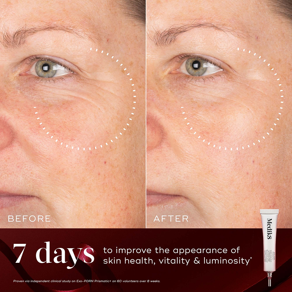 A before-and-after close-up of a participant's cheek and eye area over 7 days, demonstrating improved skin tone and luminosity, highlighted by a dotted circle. Text states "7 days to improve the appearance of skin health, vitality & luminosity." An Exo-PDRN Prismatic+ deluxe sample tube sits in the bottom right corner against a deep red background with a red ribbon.