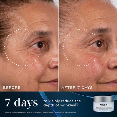 A before-and-after close-up of a participant's eye and cheek area over 7 days, demonstrating reduced wrinkle depth, highlighted by a dotted circle. Text states "7 days to visibly reduce the depth of wrinkles." An Advanced Pro-Collagen+ Peptide Cream jar sits in the bottom right corner against a dark blue background with a blue ribbon.