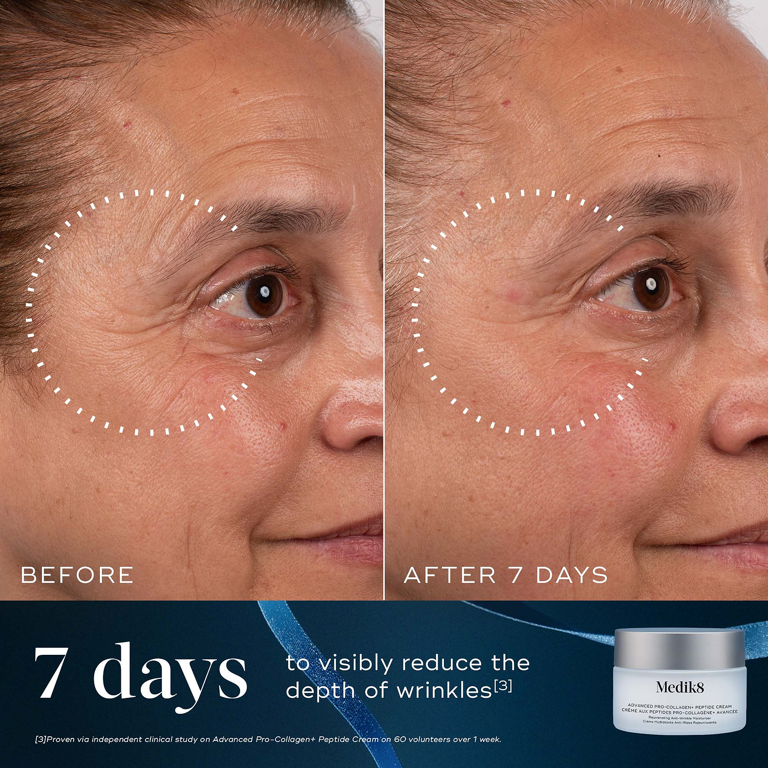 A before-and-after close-up of a participant's eye and cheek area over 7 days, demonstrating reduced wrinkle depth, highlighted by a dotted circle. Text states "7 days to visibly reduce the depth of wrinkles." An Advanced Pro-Collagen+ Peptide Cream jar sits in the bottom right corner against a dark blue background with a blue ribbon.