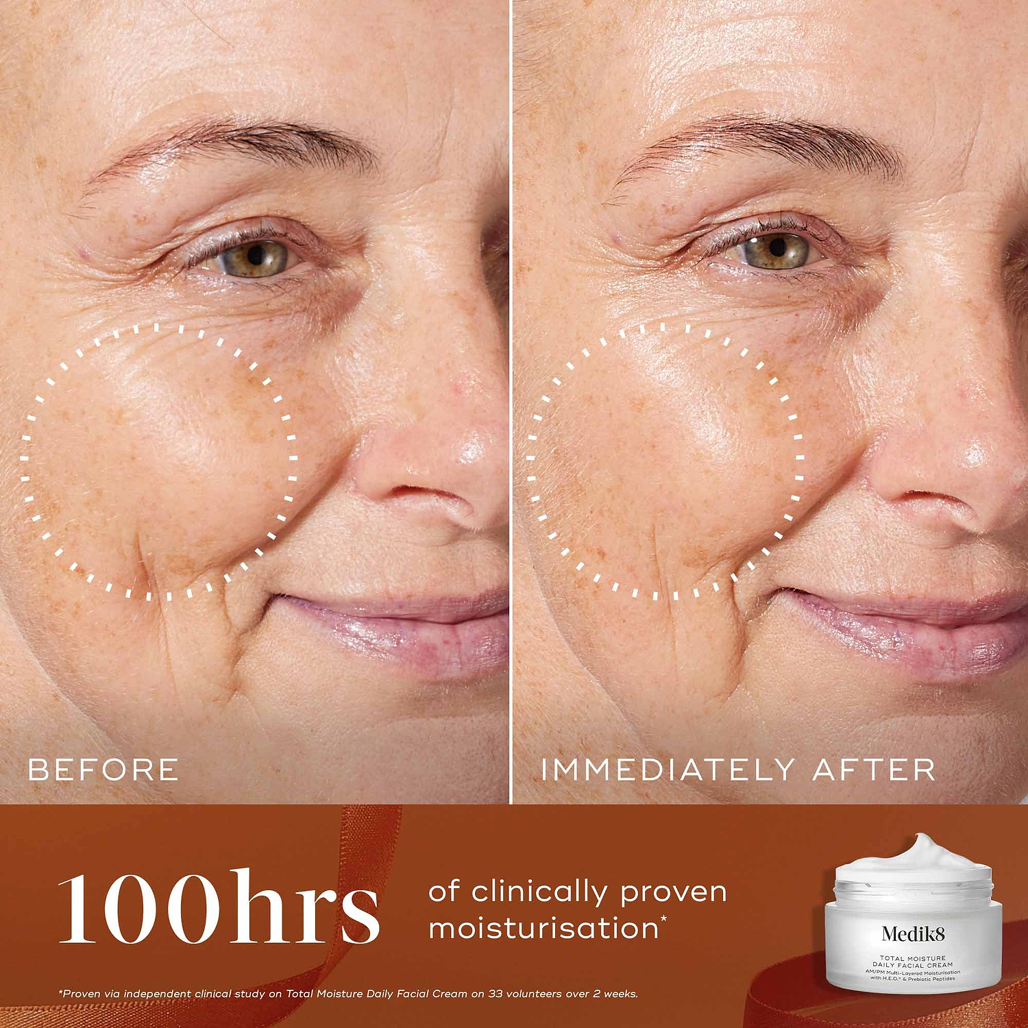 A before-and-after close-up of a participant's cheek area, showing visibly plumper and more hydrated skin immediately after use, highlighted by a dotted circle. Text states "100hrs of clinically proven moisturisation." A Total Moisture Daily Facial Cream jar sits in the bottom right corner against a burnt orange background with an orange ribbon.