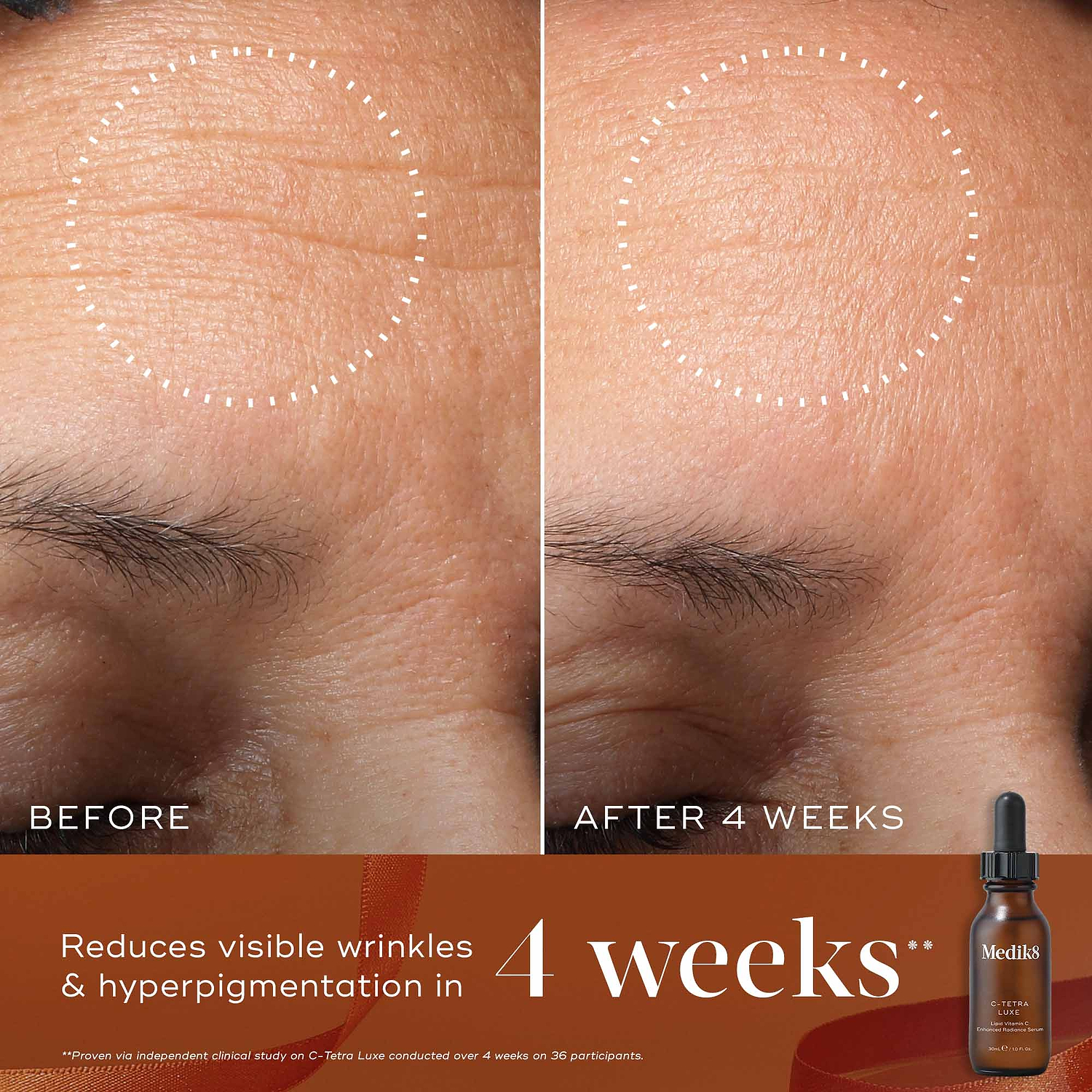 A before-and-after close-up of a participant's forehead over 4 weeks, demonstrating smoother skin texture and more even tone, highlighted by a dotted circle. Text states "Reduces visible wrinkles & hyperpigmentation in 4 weeks." A C-Tetra Luxe brown serum bottle is shown in the bottom right corner against a burnt orange background with a ribbon.