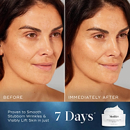 Side-by-side comparison of a woman's face labelled "Before" and "Immediately After," showing increased radiance and hydration. Text at the bottom states "Proven to Smooth Stubborn Wrinkles & Visibly Lift Skin in just 7 Days*."