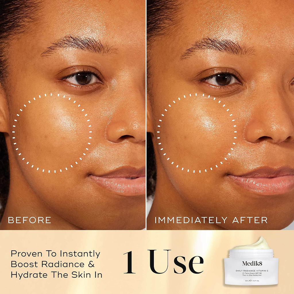 Before and after comparison of a model's face demonstrating the results of Daily Radiance Vitamin C. Dotted white circles highlight a specific area of the cheek to show a visible boost in radiance and hydration immediately after 1 use.