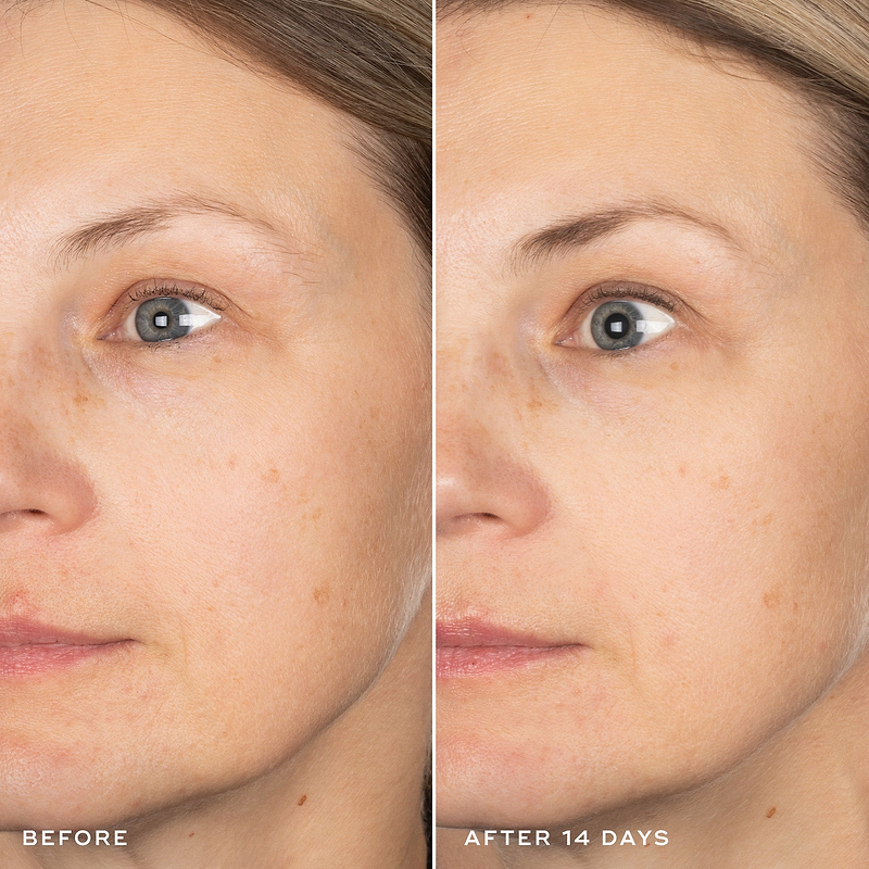 Exo-PDRN Prismatic+ Before & After 14 days