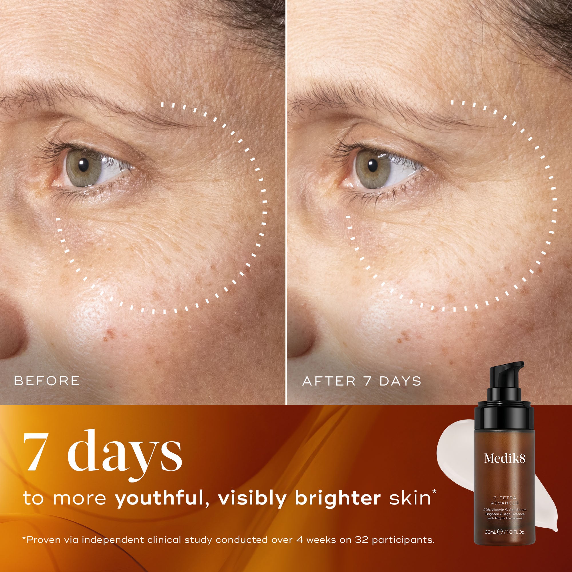 C-Tetra® Advanced - 20% Vitamin C Gel Serum with Exosomes – Medik8